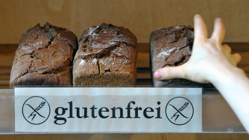 Das Geschäft mit der Laktose- und Glutenunverträglichkeit Sind laktose- und glutenfreie Lebensmittel gesünder?