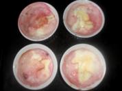 Gratinierte Erdbeeren - Rezept
