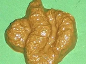 Senf-Krustenbraten - Rezept