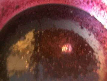 Rezept: Wald-Heidelbeermarmelade Bild Nr. 4 Wald-Heidelbeermarmelade - Rezept - Bild Nr. 4