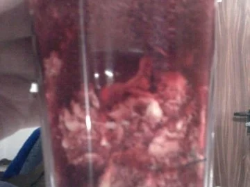 Rezept: Gehirn Gehirn - Rezept