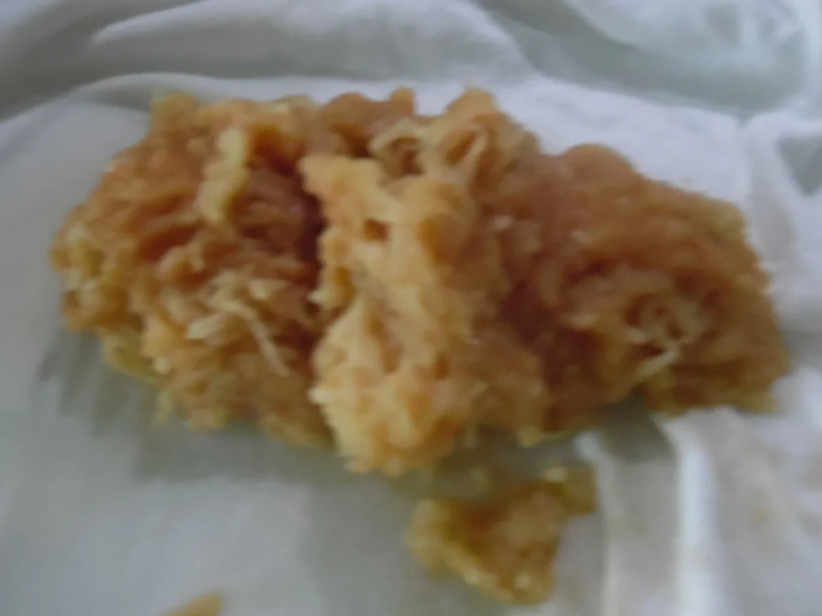 Apfel-Mandel-Bällchen - Rezept - Bild Nr. 10